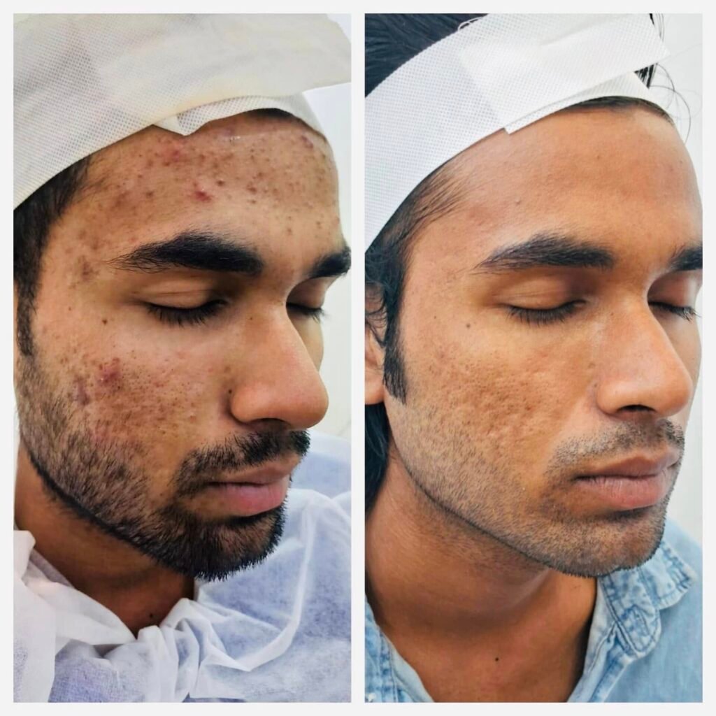 Best Dermatologist in Siliguri for male