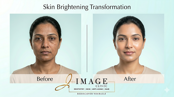 Read more about the article Glutathione Treatment in Siliguri