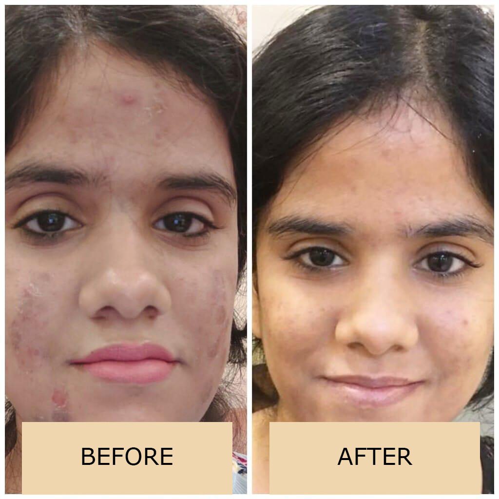 Best Skin Treatment in Kolkata | Best Dermatologist [2021]