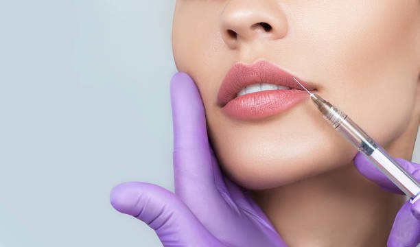 Lip Surgery Treatment