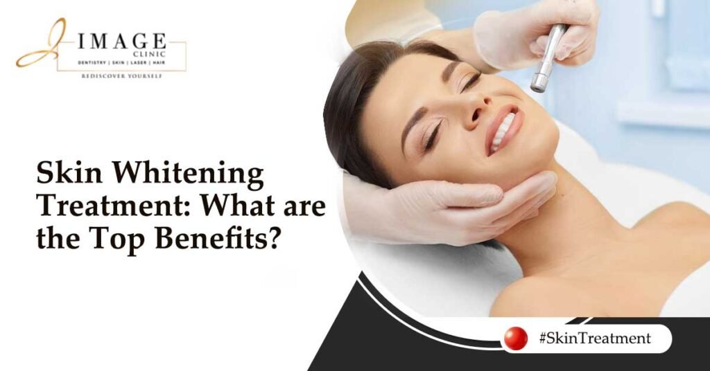 Skin Whitening Treatment What are the Top Benefits