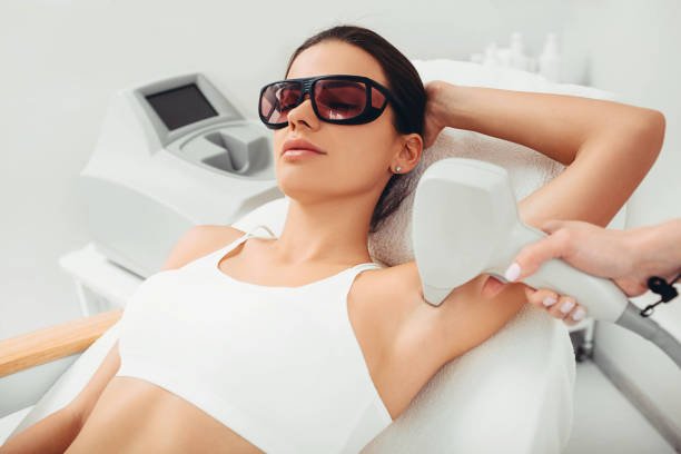 laser hair removal