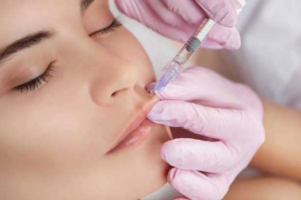 fillers treatment