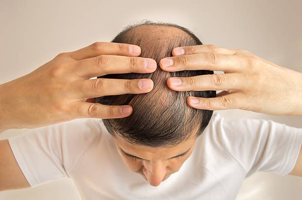 Hair Loss Treatment in Kolkata