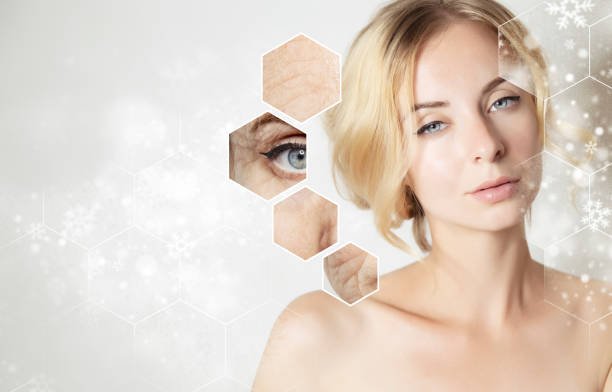 Botox Treatment