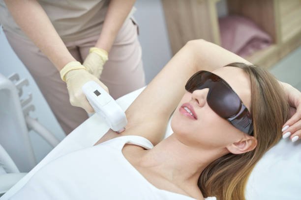 Laser Hair Removal