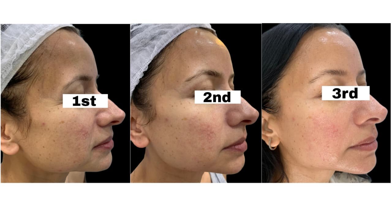 Image Clinic before after (20)
