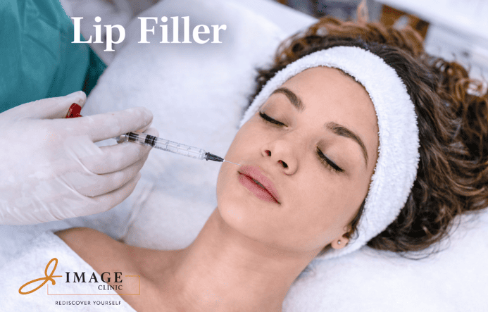 Lip Filler