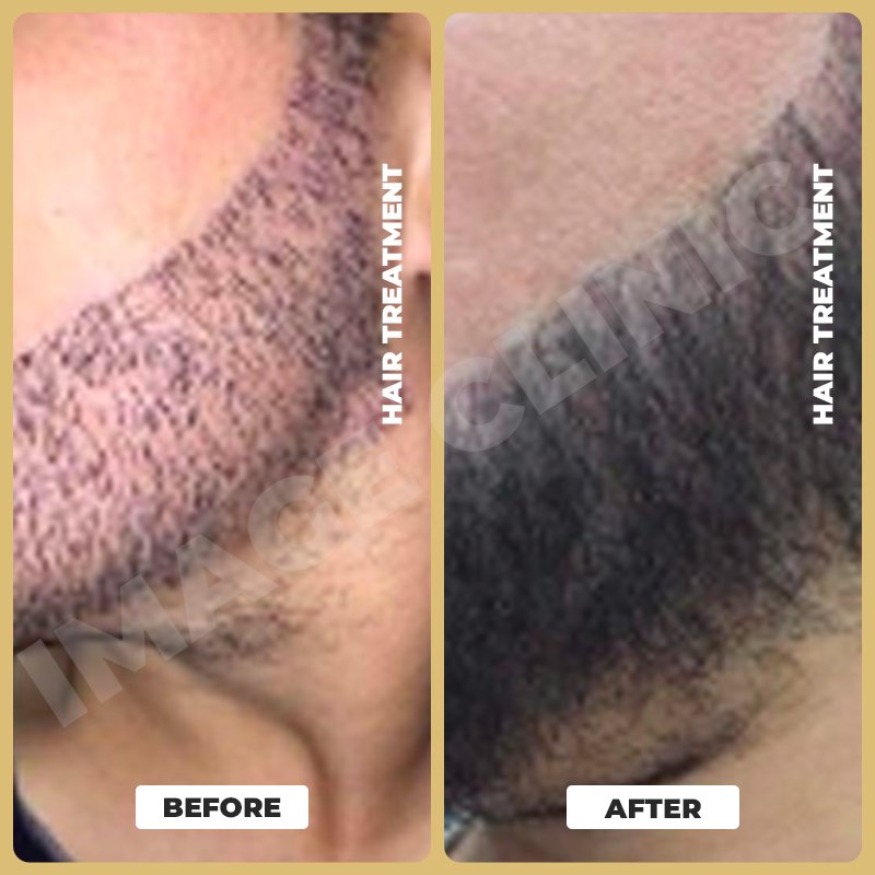 Hair Treatment-5.jpg