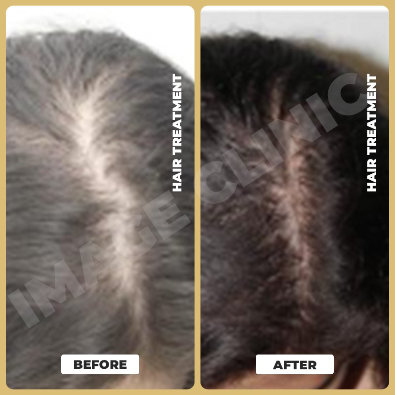 Hair Treatment-6.jpg
