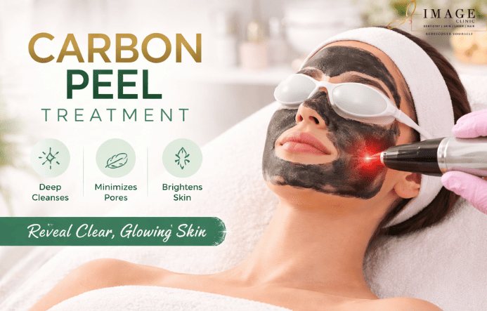 Carbon Peel Treatment in Kolkata