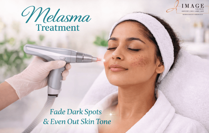 Melasma Treatment in Kolkata