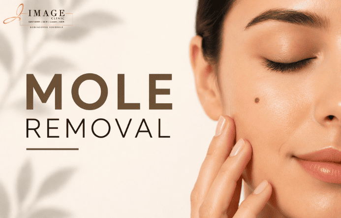 Mole Removal