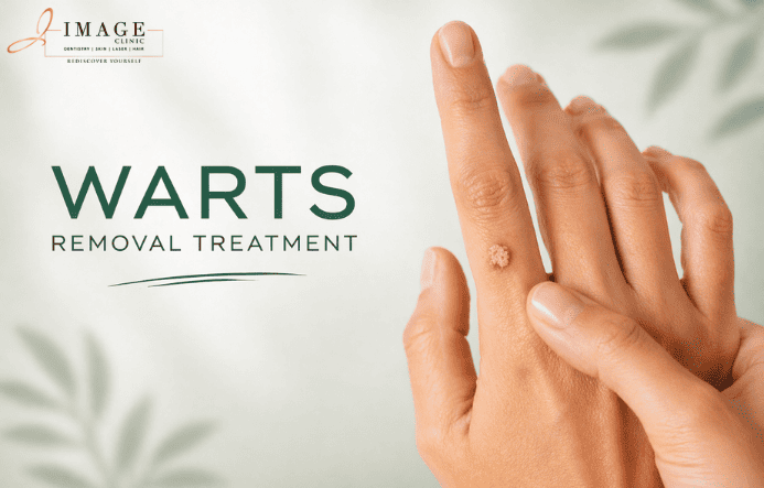 Wart Removal Treatment