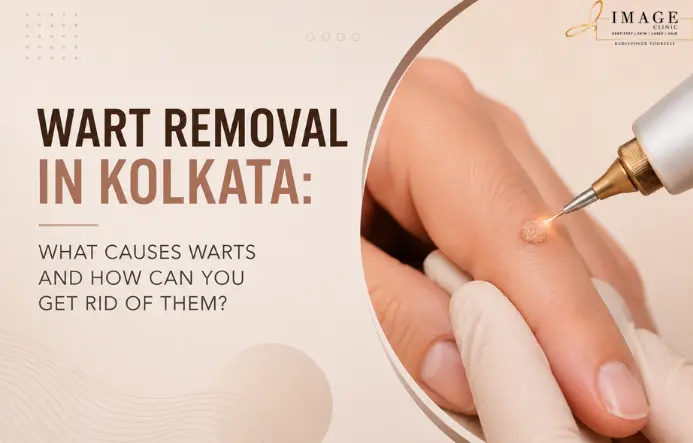 Wart Removal in Kolkata