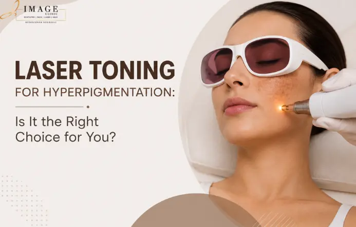 Laser Toning for Hyperpigmentation