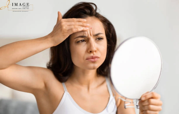 dull skin treatment programme in Kolkata