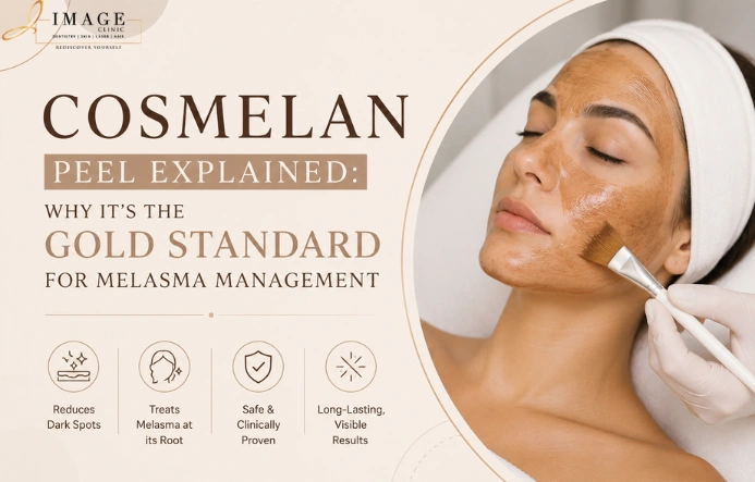 Cosmelan Peel