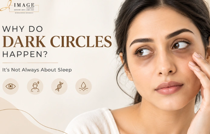 Dark Circles Happen