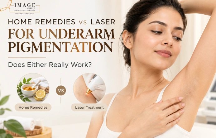 Laser for Underarm Pigmentation