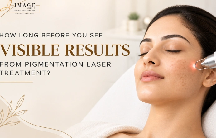 hyperpigmentation laser treatment