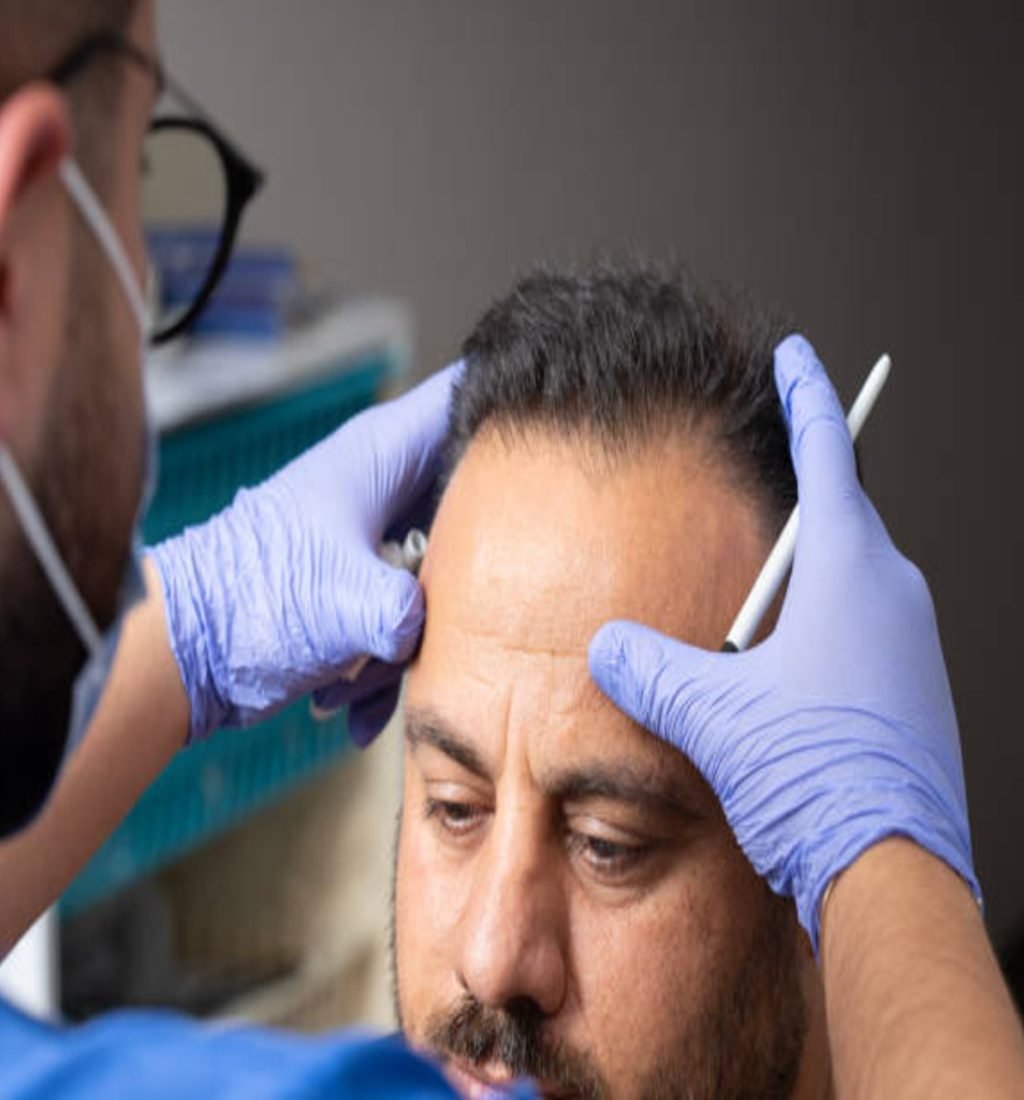 hair restoration hair restoration